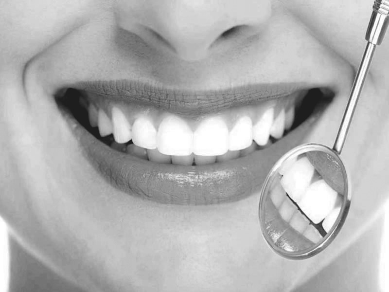 Teeth Whitening Dentists in Reston